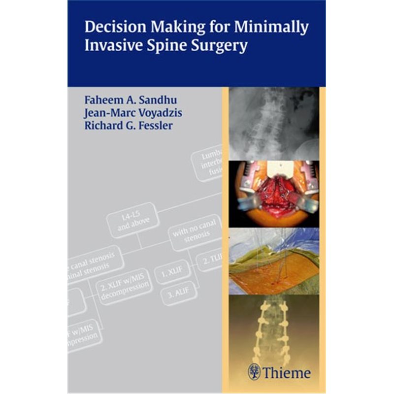 Decision Making for Minimally Invasive Spine Surgery
